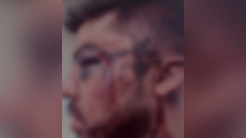 Rapper Uryel Rhander, sofreu um espancamento brutal na 410 Norte, Asa Norte, em Brasília