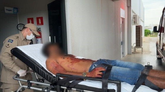 Ciumenta briga com o marido e o golpeia usando faca de serra em Sorriso/MT