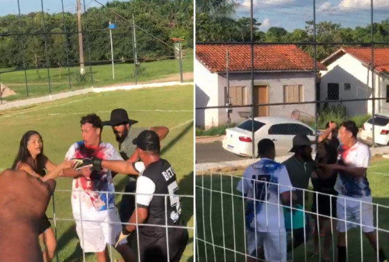 Jogador Sofre Tentativa de Homicídio Durante Partida