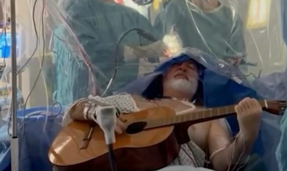 Músico toca violão durante cirurgia cerebral em Londres para remover tumor; VEJA VÍDEO
