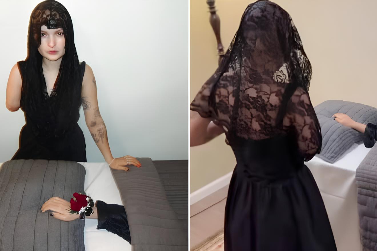 Com câncer raro, tiktoker faz “funeral” para braço após amputação