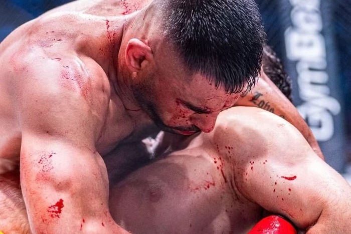 Vídeo: lutador quebra mandíbula e vence luta com finalização brutal no MMA