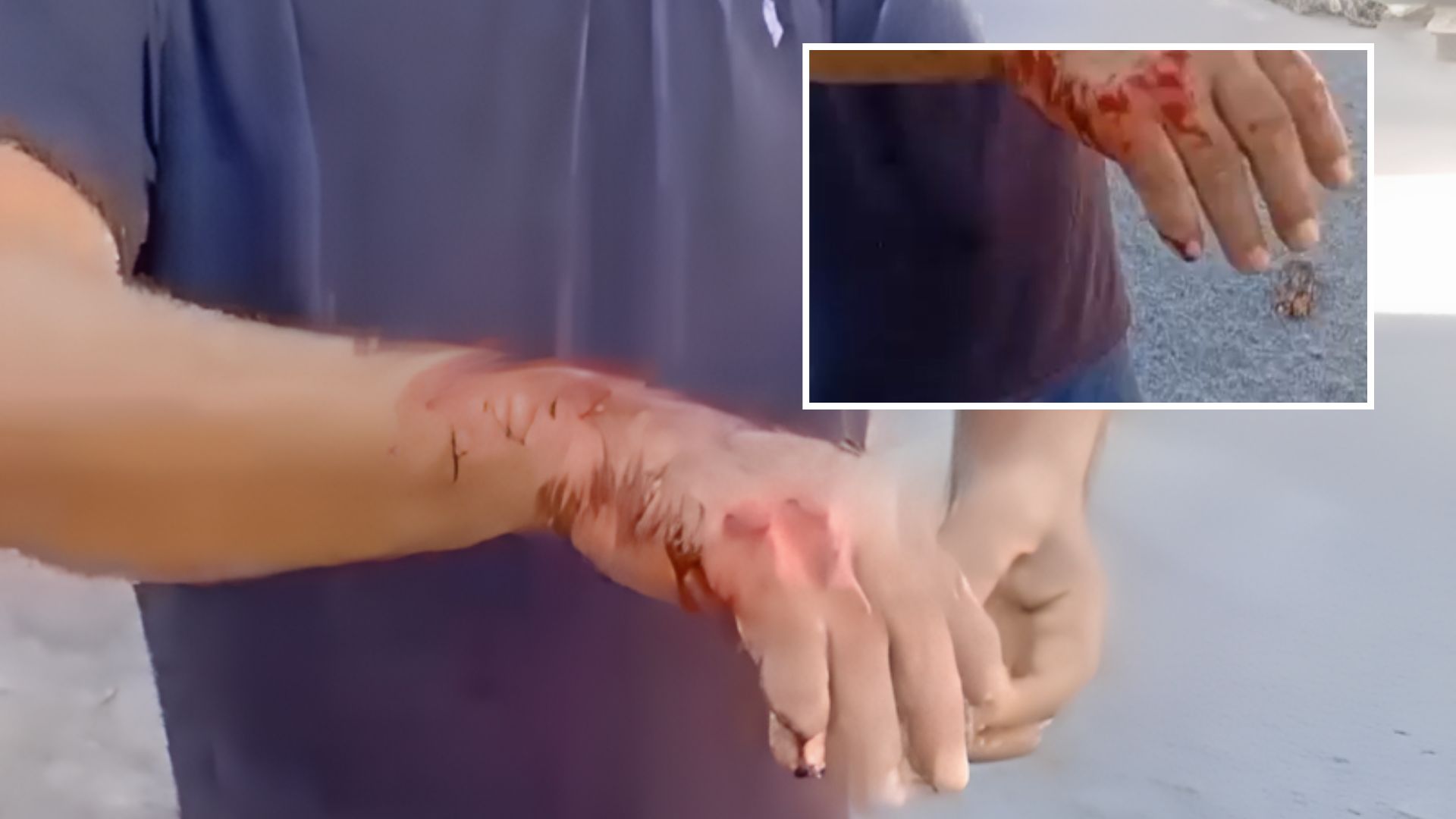 Ataque em Barra do Garças: pitbull escapa, mata cachorro e fere tutor durante passeio; veja vídeo