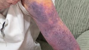 Idoso denuncia abandono, maus-tratos e apropriação de bens pela própria família; veja vídeo