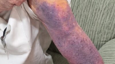 Idoso denuncia abandono, maus-tratos e apropriação de bens pela própria família; veja vídeo