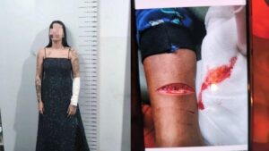 Mulher é detida pela Polícia Militar após ferir o próprio filho em Cuiabá; veja vídeo