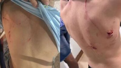 Rottweiler ataca três crianças em praças de Campo Novo do Parecis; veja vídeo