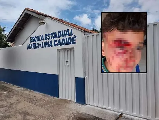 Estudante sofre violência após histórico de bullying dentro de escola em MT; veja vídeo