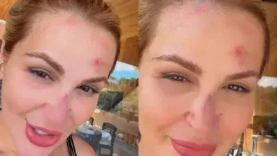 VÍDEO: Deolane surge machucada após acidente doméstico e assusta seguidores