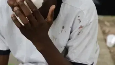 Explosão de bomba caseira fere 10 alunos em escola; veja vídeo