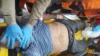 Idoso sofre acidente de motocicleta e tem parada cardiorrespiratória durante atendimento em Cáceres